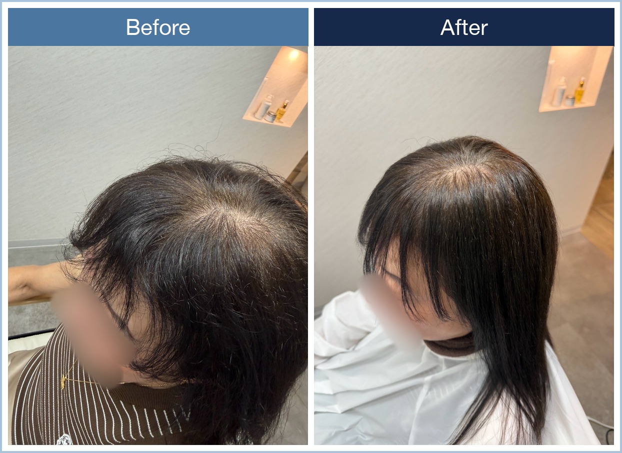 前髪の広がり・うねりが縮毛矯正で落ち着いたBefore・After比較写真。Beforeは根元が広がりまとまりにくい状態、Afterは根元が自然に落ち着き柔らかさが残っている