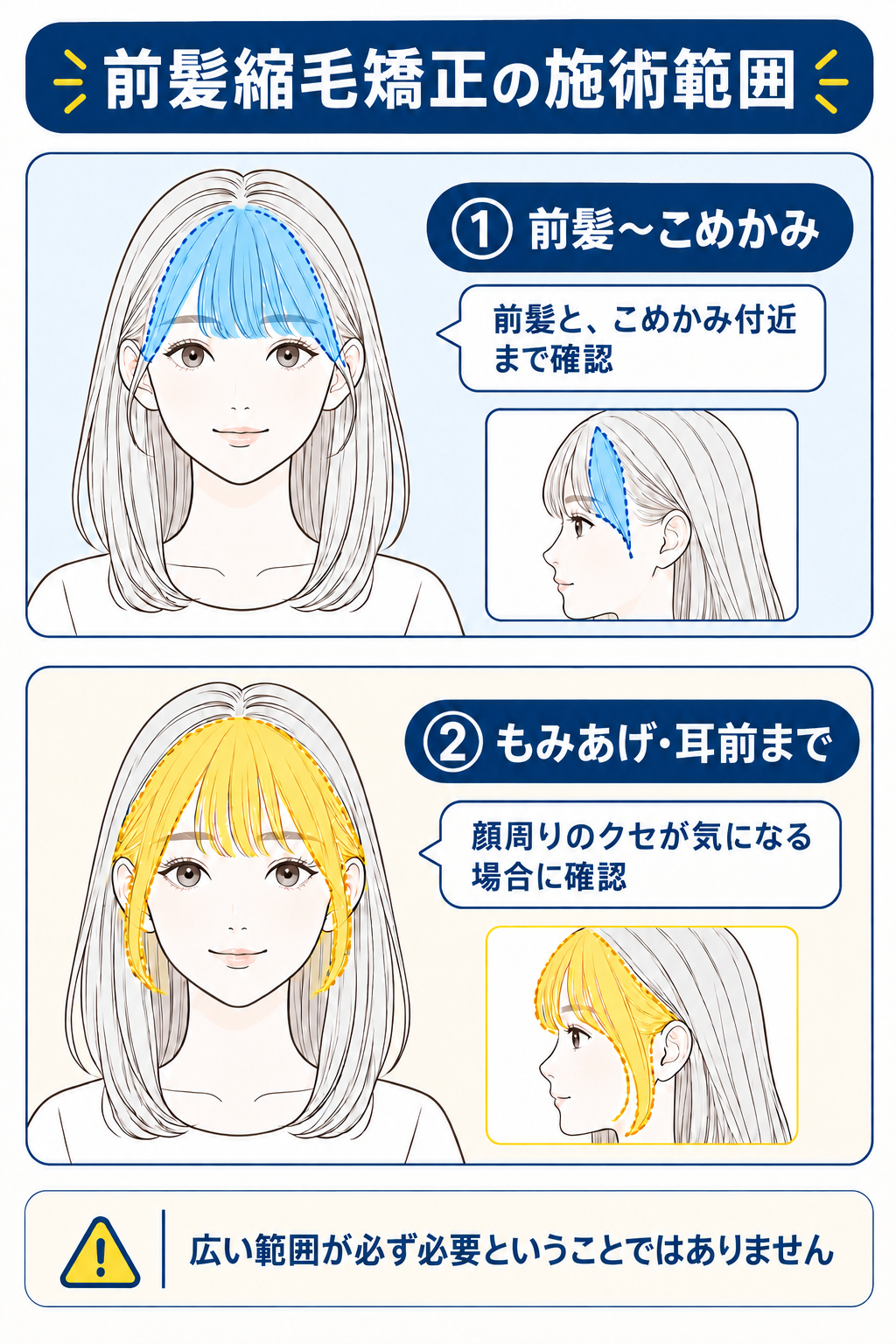 前髪縮毛矯正の施術範囲。①前髪〜こめかみ、②もみあげ・耳前まで。広い範囲が必ず必要ということではありません
